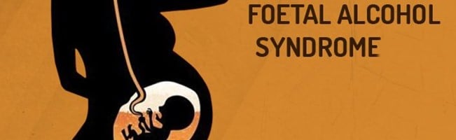Foetal Alcohol Syndrome