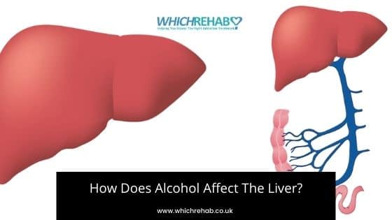 Alcohol addiction affecting your liver